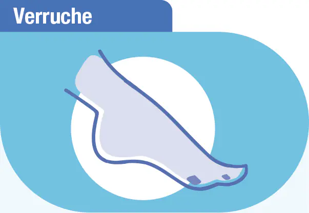 Duofilm verruche